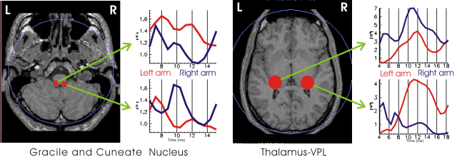 Activity in medulla and thalamus