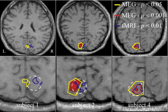 MEG fMRI co-localization
