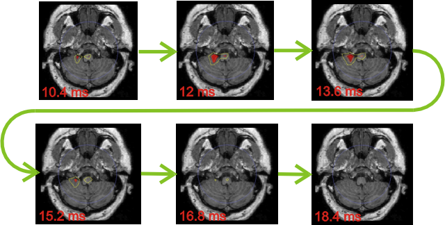 Somatosensory activity from brainstem to cerebellum25