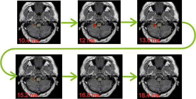 Sequence of activity from brainstem to cerebellum